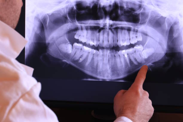 Best Broken or Chipped Tooth Repair in Brilliant, AL