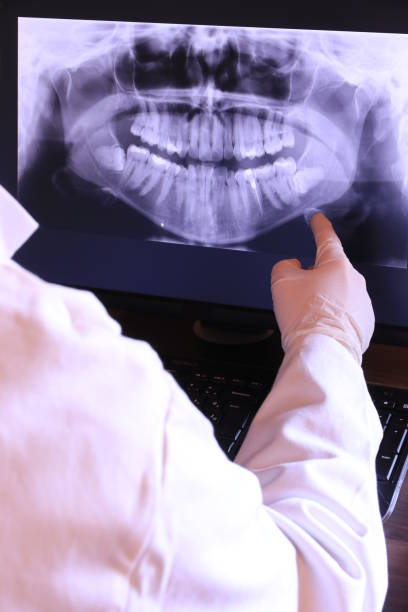 Best Emergency Treatment for Oral Infections in Brilliant, AL